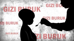 Dalam 6 bulan, Angka Gizi Buruk di Ambon Naik